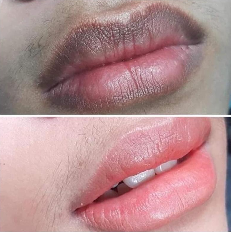 Khi đàn ông bắt đầu quan tâm đến khử thâm môi 3 sg 11134201 22120 wmuu119nxjkv0f e1761103583323