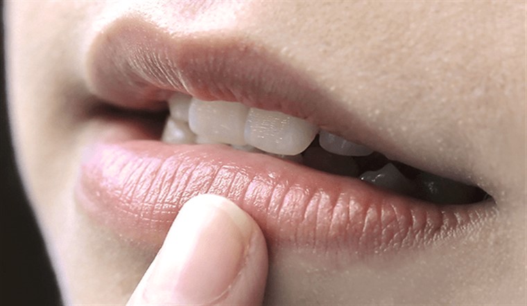 Môi thâm bẩm sinh có khử được không?