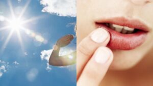 tai sao moi tham lam gi de khac phuc tinh trang moi tham 202111152105344902