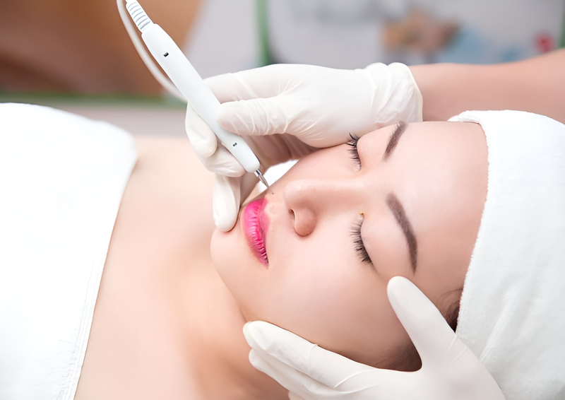 Nốt ruồi ở lưỡi tốt hay xấu và có nên tẩy hay không? 3 Tẩy nốt ruồi bao nhiêu tiền? Cách chăm sóc da chuẩn y khoa sau khi tẩy nốt ruồi