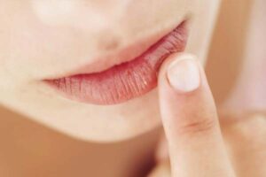 Môi sau khử có được hôn không?