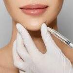 Tiêm filler cằm có nặn mụn được không? Những thông tin liên quan đến tiêm filler