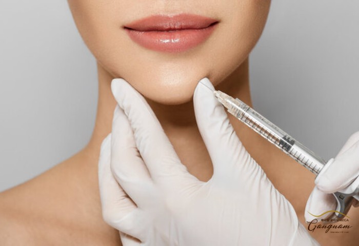 Đang niềng răng có tiêm filler được không?