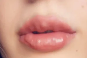 tiem filler moi bi von cuc