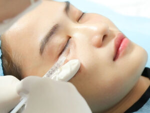 Phun mí kết hợp filler vùng đuôi mắt – thế nào cho hài hòa?