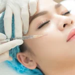 Tiêm filler uống cafe được không? Cần kiêng những gì sau tiêm?