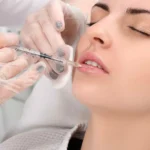 Tiêm filler bị nhức phải làm sao?