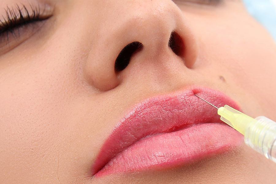 Filler môi hoạt động như thế nào? 