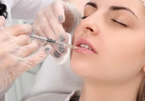 Tiêm filler môi giữ được bao lâu?
