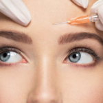 Tiêm filler xóa nhăn trán và tiêm botox khác nhau như thế nào?