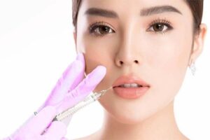 tran phi yen filler botox 841883