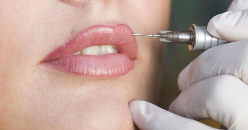 Khử thâm môi nữ có cần dặm lại không?