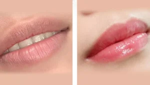 Top 3 tone màu môi sau khử