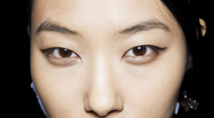 Mí xếch sau phun có khiến khuôn mặt “dữ” hơn không?