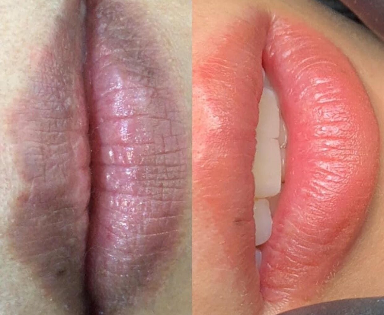 Khử thâm môi có giúp môi hồng tự nhiên mà không bóng không? 1 z3426128087731 632f83ff241e5f919ba06511df1a60da e1760359356947