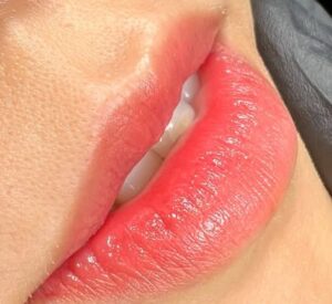 Khử thâm môi bằng phun môi mực hữu cơ