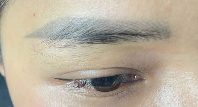 Phun mày bị xanh phải làm gì? Nguyên nhân – cách xử lý triệt để – an toàn