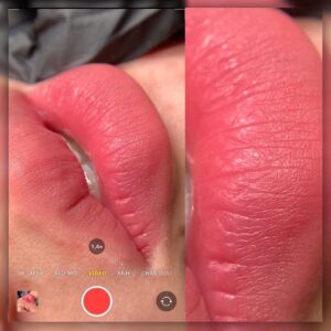 Xăm môi không lên màu: 9 lý do & cách xử lý để màu chuẩn đẹp