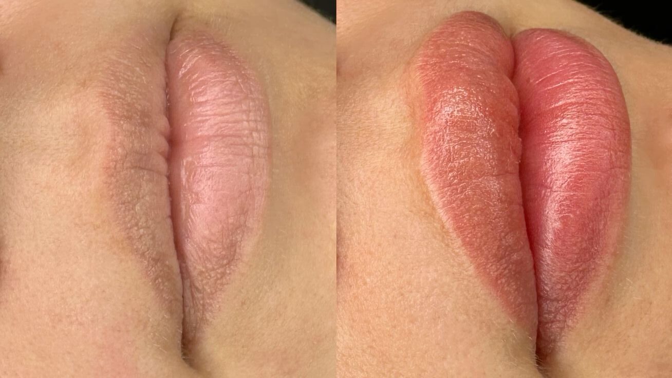 Khử thâm môi ở đâu đẹp? 4 Khử thâm môi ở đâu đẹp