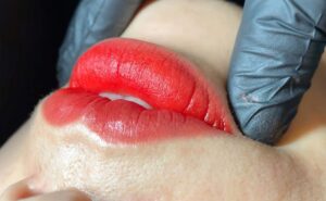 Khắc phục môi bị thâm lại – Giải pháp cho đôi môi tươi tắn, tự tin