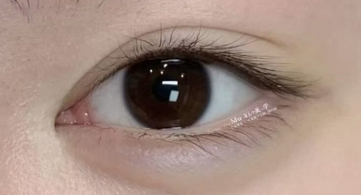 Phun mí mở tròng có giữ được lâu không?