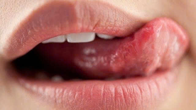 Nguyen nhan gay tham moi va moi toi mau