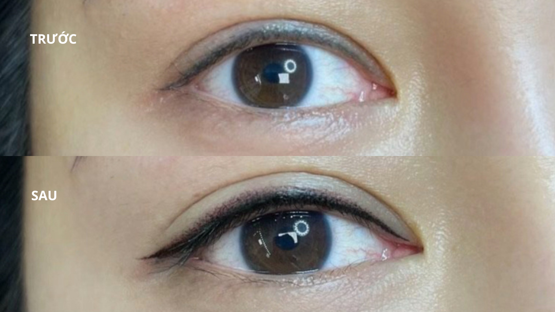 Phun mí mở tròng là gì? Có làm mắt to hơn thật không? 4 TRUOC 2
