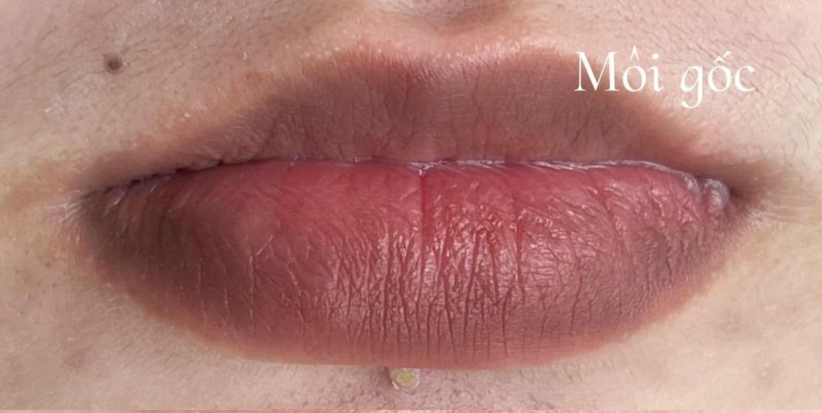 Môi thâm có phun xăm được không? Giải pháp cho người môi sẫm màu
