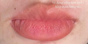Môi thâm có phun xăm được không? Giải pháp cho người môi sẫm màu