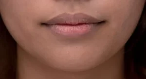 Xăm môi bị thâm phải làm sao? Nguyên nhân & cách khắc phục