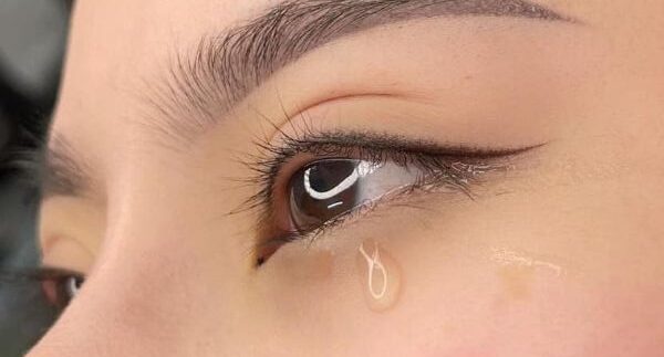 Phun mí mở tròng phù hợp với mắt nào?