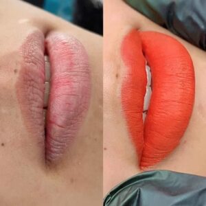 Khử thâm môi nhanh tại TP.HCM