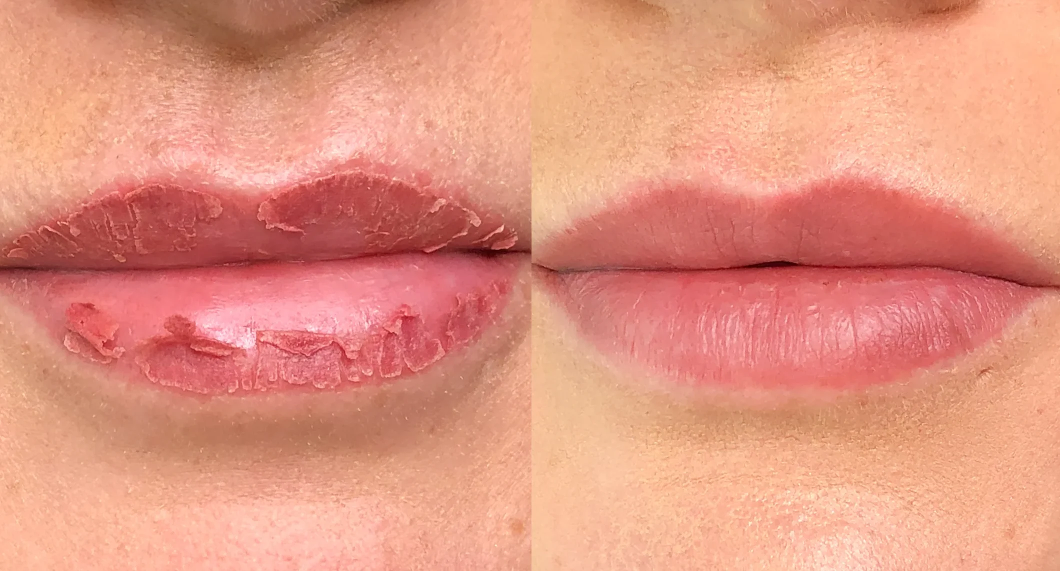 healingdaybydaylips 1 e1764144255445