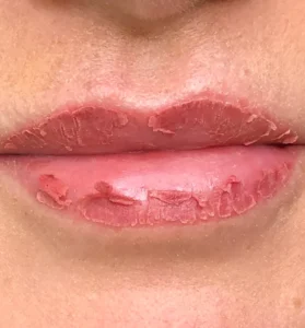 healingdaybydaylips 1 e1764732221161