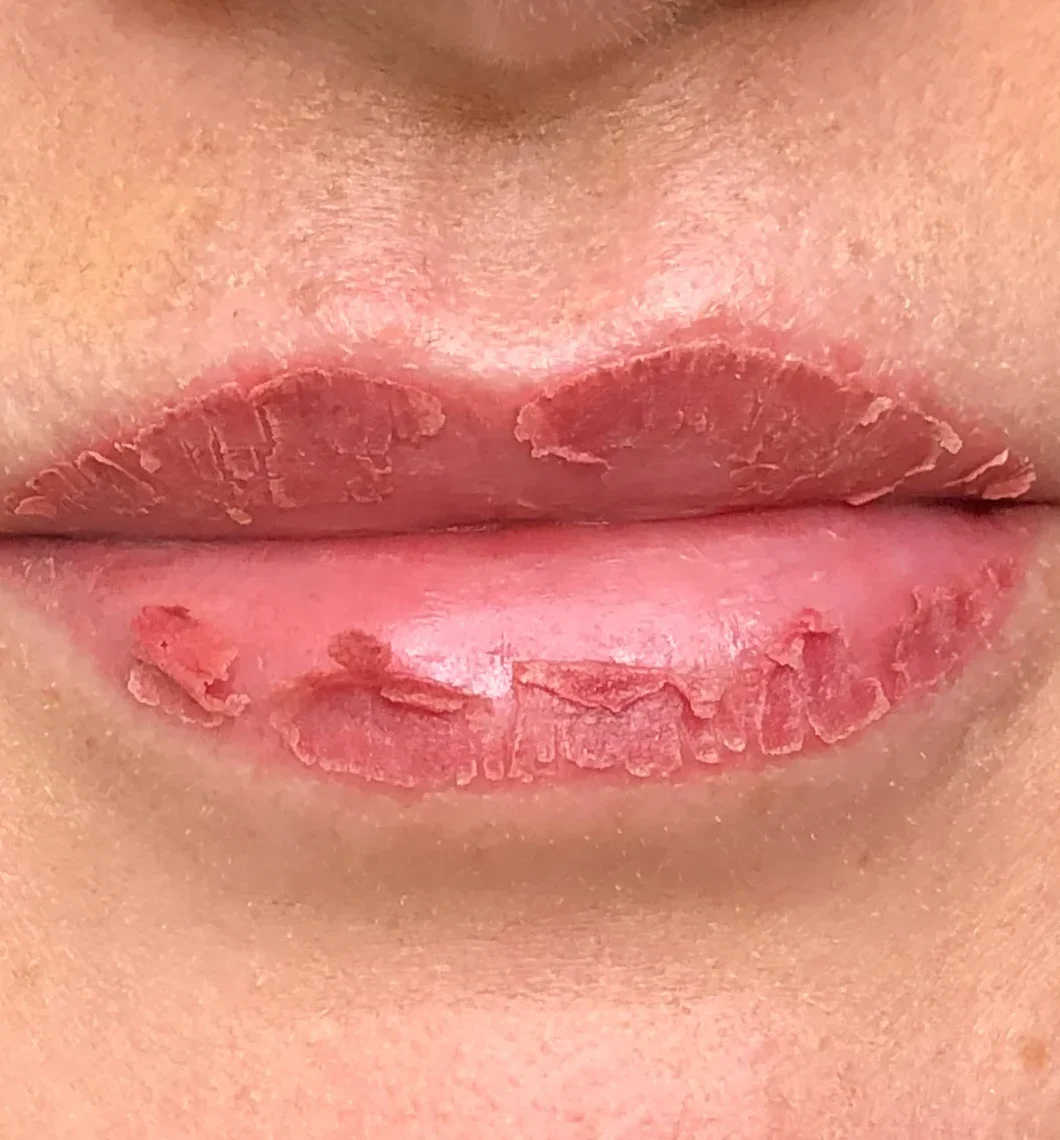 healingdaybydaylips 1 e1764732221161