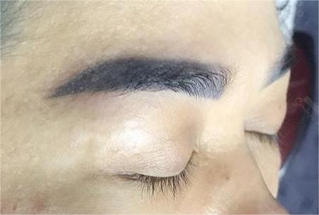 Chân mày bị nhem khi mới phun: bình thường hay bất thường?