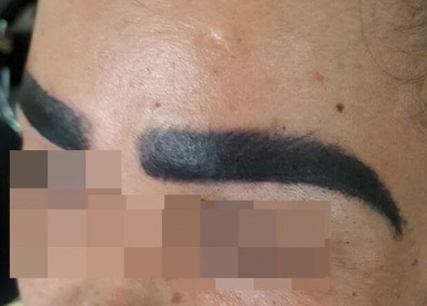 Vì sao chân mày bị nhem? Dấu hiệu nhận biết và hướng khắc phục 3 phun theu long may hong 1516381481 342 width620height557 e1764398735790