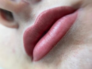 Xử lý môi bị thâm lại là gì? Quy trình chuẩn và kết quả mong đợi