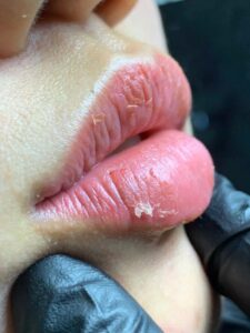 7 dấu hiệu phun môi không lên màu bạn cần biết sớm để tránh hỏng môi