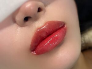 Phun môi xong nhưng môi không bong là dấu hiệu gì? Giải đáp chi tiết