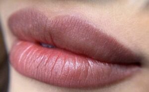 Khử thâm môi và phun môi collagen khác nhau thế nào?