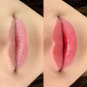 Quy trình phun môi màu hồng ổi tại spa: an toàn, nhẹ nhàng, chuẩn kỹ thuật