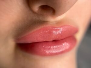 Phun môi không bong: dấu hiệu gì?