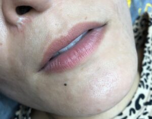 Tại sao môi thâm không nên phun màu đỏ ngay? – Cảnh báo quan trọng trước khi làm đẹp