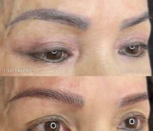 Xoá chân mày bị trổ xanh – Kỹ thuật xử lý đúng 2026