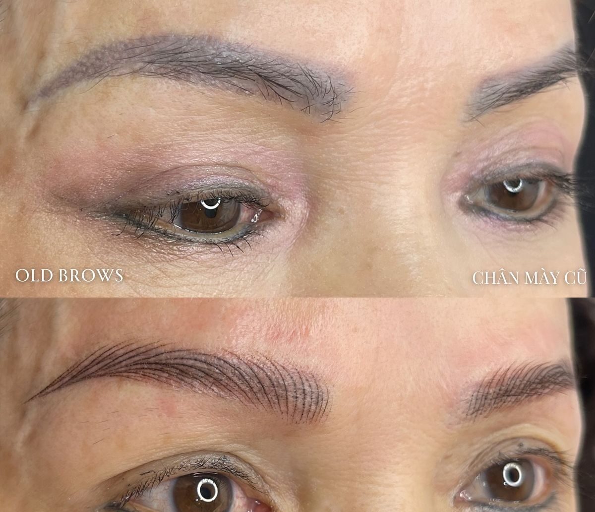 Xoá chân mày bị trổ xanh – Kỹ thuật xử lý đúng 2026