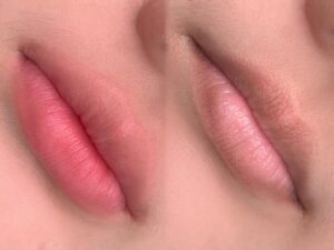 Khử thâm môi trước – phun màu sau: bí quyết để môi lên đúng tông