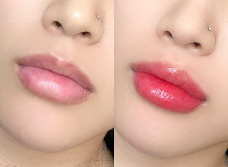 phun môi cho môi thâm lâu năm