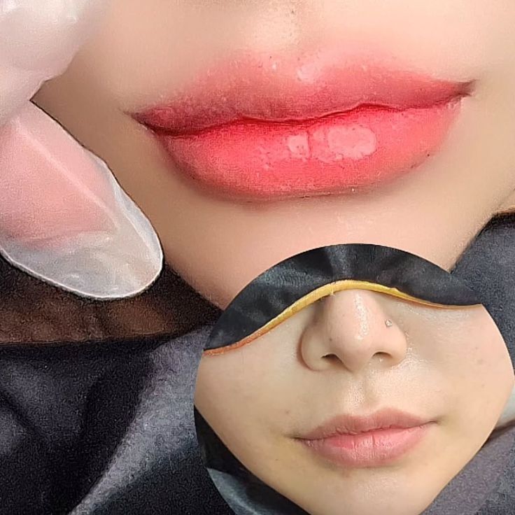 Những nguyên nhân khiến môi thâm và cách khắc phục hiệu quả 4 Phun môi collagen có bền không?