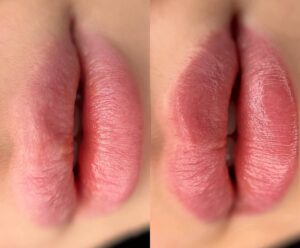 Phun môi màu hồng trầm có hợp da ngăm không? Giải đáp chi tiết